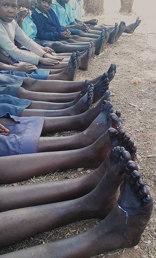 Vaseline zur Beruhigung der Haut