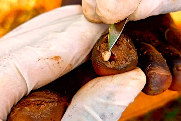 Behandlung mit dem Skalpell